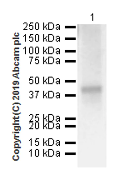 Western blot - Anti-Asialoglycoprotein Receptor 1/HL-1 antibody [EPR22639-68] (AB254261)