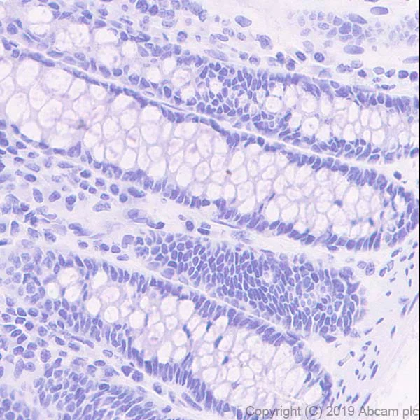 Immunohistochemistry (Formalin/PFA-fixed paraffin-embedded sections) - Anti-Asialoglycoprotein Receptor 1/HL-1 antibody [EPR22639-68] - BSA and Azide free (AB256352)