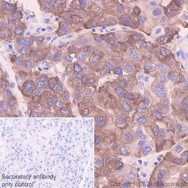 Immunohistochemistry (Formalin/PFA-fixed paraffin-embedded sections) - Anti-Asialoglycoprotein Receptor 1/HL-1 antibody [EPR22639-68] - BSA and Azide free (AB256352)