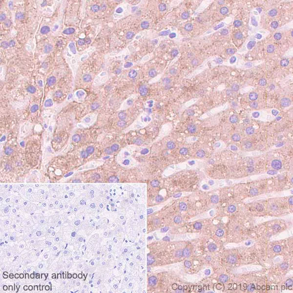 Immunohistochemistry (Formalin/PFA-fixed paraffin-embedded sections) - Anti-Asialoglycoprotein Receptor 1/HL-1 antibody [EPR22642-17] (AB254262)