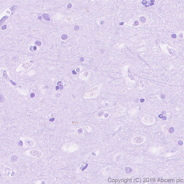 Immunohistochemistry (Formalin/PFA-fixed paraffin-embedded sections) - Anti-Asialoglycoprotein Receptor 1/HL-1 antibody [EPR22642-17] (AB254262)