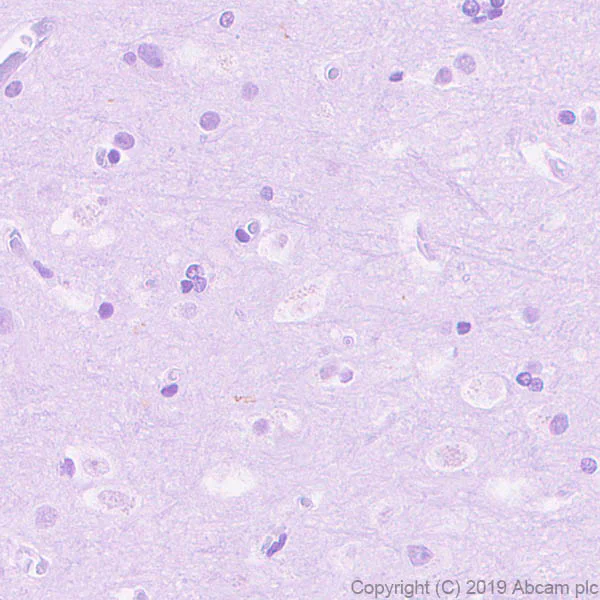 Immunohistochemistry (Formalin/PFA-fixed paraffin-embedded sections) - Anti-Asialoglycoprotein Receptor 1/HL-1 antibody [EPR22642-17] (AB254262)