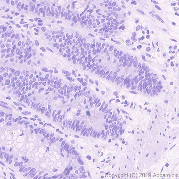 Immunohistochemistry (Formalin/PFA-fixed paraffin-embedded sections) - Anti-Asialoglycoprotein Receptor 1/HL-1 antibody [EPR22642-17] (AB254262)