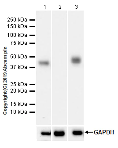 Western blot - Anti-Asialoglycoprotein Receptor 1/HL-1 antibody [EPR22642-17] (AB254262)
