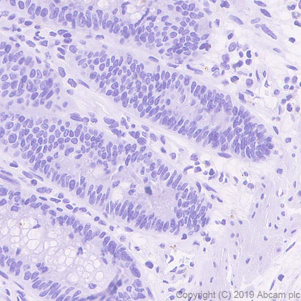 Immunohistochemistry (Formalin/PFA-fixed paraffin-embedded sections) - Anti-Asialoglycoprotein Receptor 1/HL-1 antibody [EPR22642-17] - BSA and Azide free (ab256509), expandable thumbnail