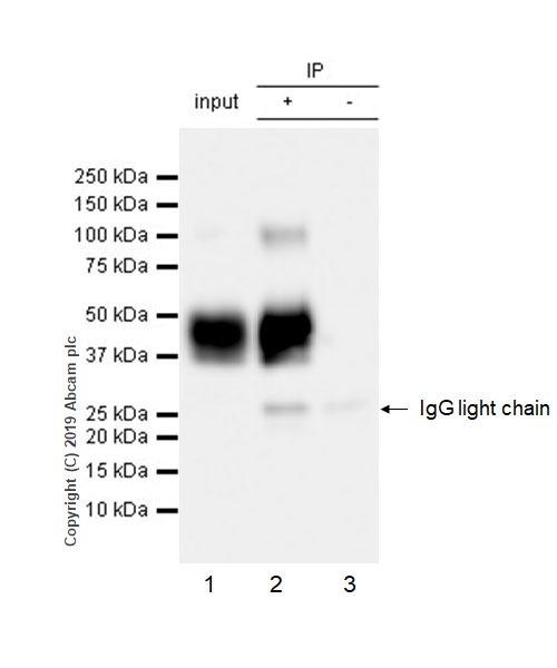 Immunoprecipitation - Anti-Asialoglycoprotein Receptor 1/HL-1 antibody [EPR22642-17] - BSA and Azide free (AB256509), expandable thumbnail