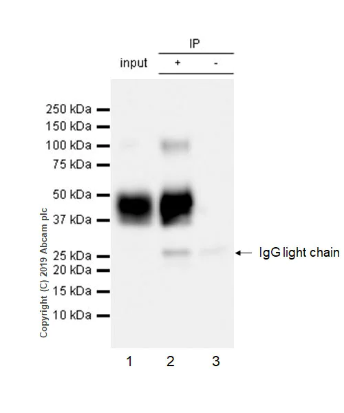 Immunoprecipitation - Anti-Asialoglycoprotein Receptor 1/HL-1 antibody [EPR22642-17] - BSA and Azide free (AB256509)