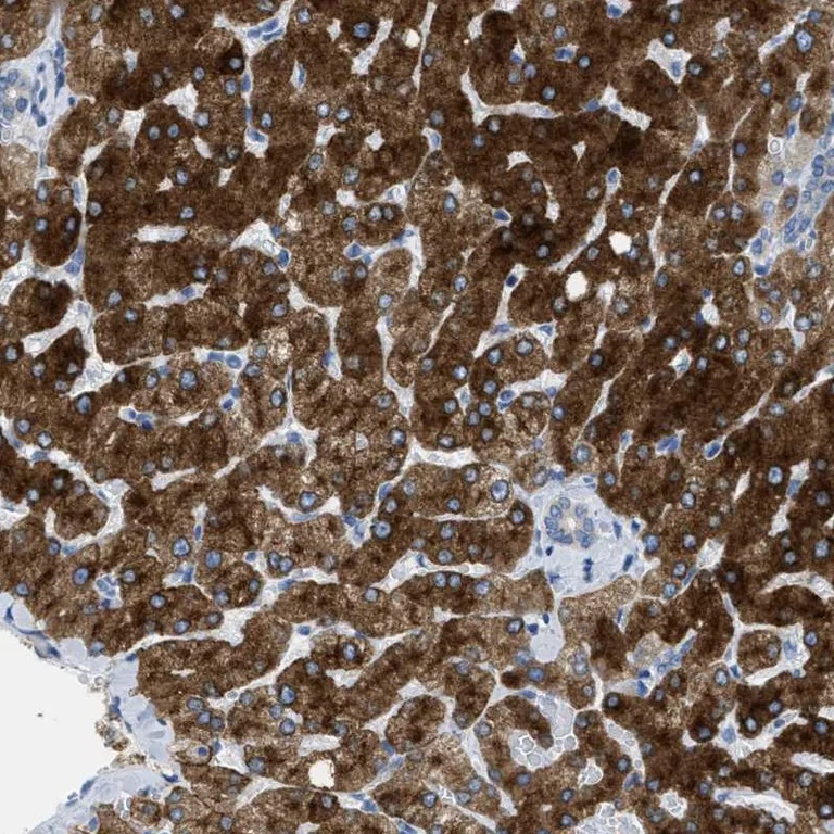 Immunohistochemistry (Formalin/PFA-fixed paraffin-embedded sections) - Anti-Asialoglycoprotein Receptor 1/HL-1 antibody - N-terminal (AB223769)