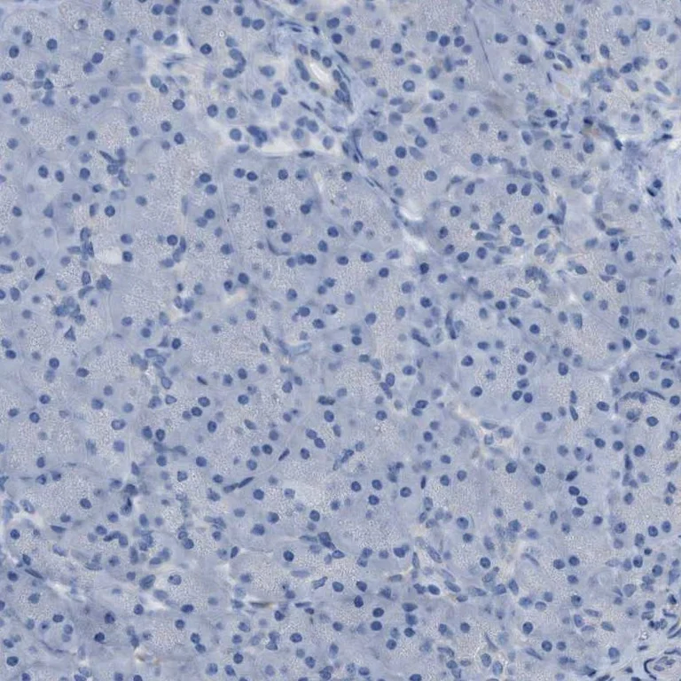 Immunohistochemistry (Formalin/PFA-fixed paraffin-embedded sections) - Anti-Asialoglycoprotein Receptor 1/HL-1 antibody - N-terminal (AB223769)