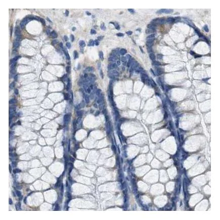 Immunohistochemistry (Formalin/PFA-fixed paraffin-embedded sections) - Anti-Asialoglycoprotein Receptor 1/HL-1 antibody - N-terminal (AB223769)