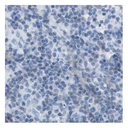 Immunohistochemistry (Formalin/PFA-fixed paraffin-embedded sections) - Anti-Asialoglycoprotein Receptor 1/HL-1 antibody - N-terminal (AB223769)