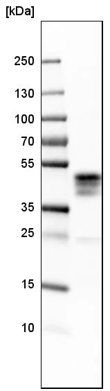 Western blot - Anti-Asialoglycoprotein Receptor 1/HL-1 antibody - N-terminal (AB223769)