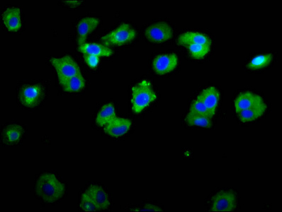 Immunocytochemistry/ Immunofluorescence - Anti-ASIC1 antibody (AB236770)