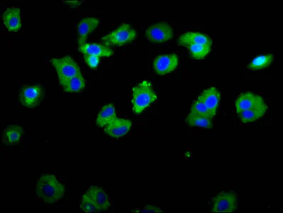 Immunocytochemistry/ Immunofluorescence - Anti-ASIC1 antibody (AB236770)