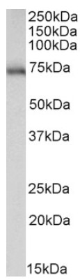 Western blot - Anti-ASIC1 antibody - C-terminal (AB205387)