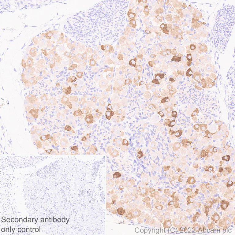 Immunohistochemistry (Formalin/PFA-fixed paraffin-embedded sections) - Anti-ASIC1 antibody [EPR25411-161] (AB300563)