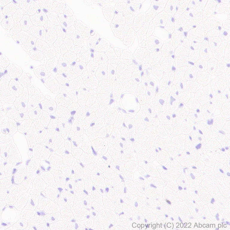 Immunohistochemistry (Formalin/PFA-fixed paraffin-embedded sections) - Anti-ASIC1 antibody [EPR25411-161] (BSA and Azide free) (AB300564)