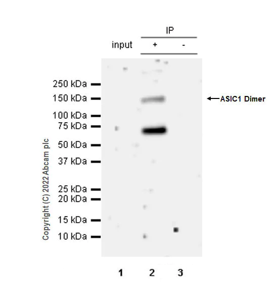 Immunoprecipitation - Anti-ASIC1 antibody [EPR25411-161] (BSA and Azide free) (AB300564)