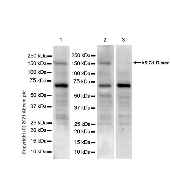 Western blot - Anti-ASIC1 antibody [EPR25411-45] (AB284406)
