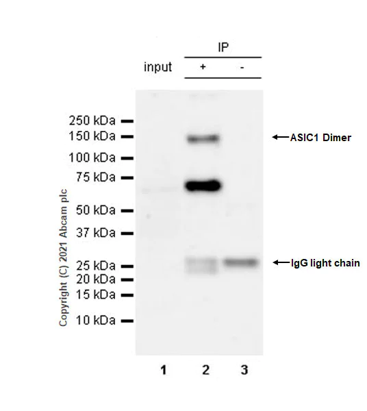 Immunoprecipitation - Anti-ASIC1 antibody [EPR25411-45] - BSA and Azide free (AB284410)