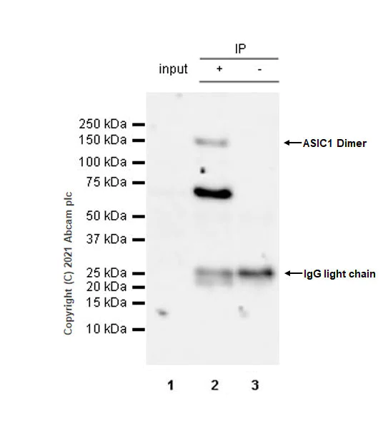 Immunoprecipitation - Anti-ASIC1 antibody [EPR25411-45] - BSA and Azide free (AB284410)