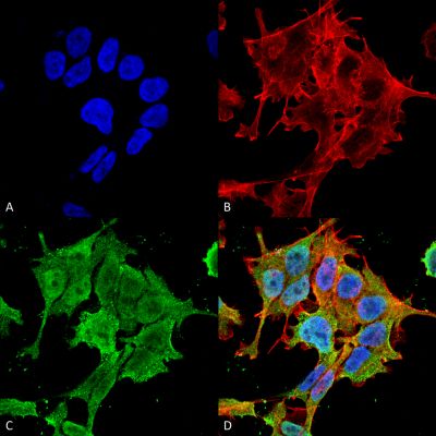 Immunocytochemistry/ Immunofluorescence - Anti-ASIC1 antibody [S271-44] (AB240896)