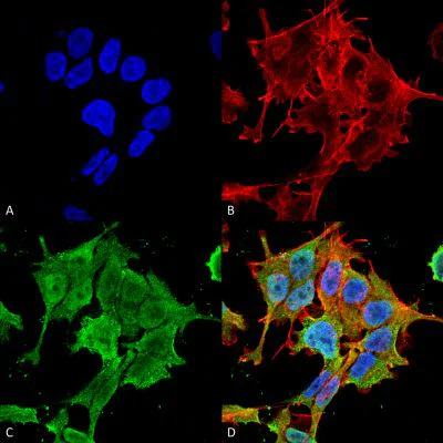 Immunocytochemistry/ Immunofluorescence - Anti-ASIC1 antibody [S271-44] (AB240896)