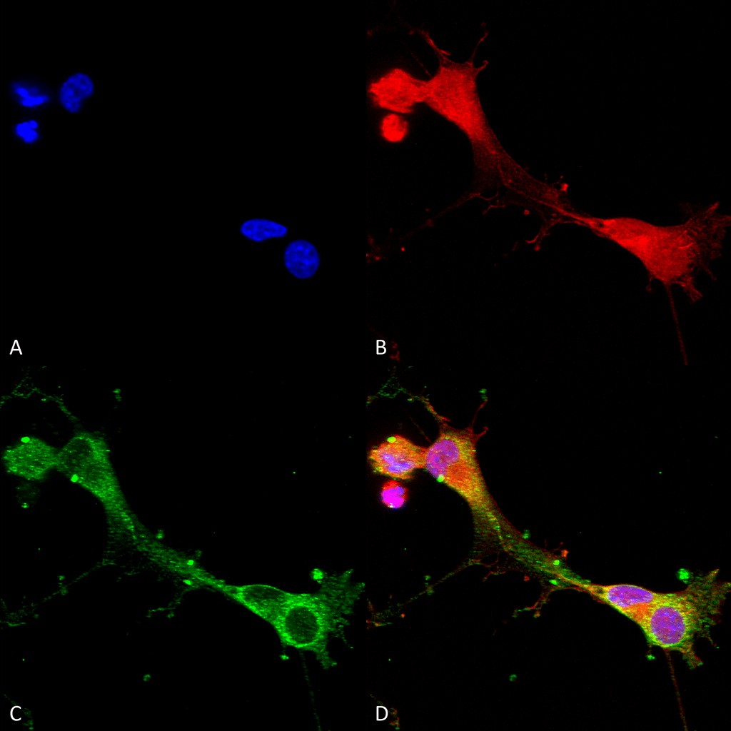 Immunocytochemistry/ Immunofluorescence - Anti-ASIC1 antibody [S271-44] (AB240896)