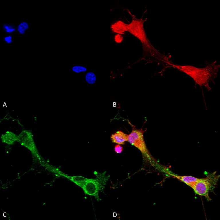 Immunocytochemistry/ Immunofluorescence - Anti-ASIC1 antibody [S271-44] (AB240896)