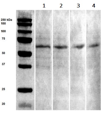 Western blot - Anti-ASIC1 antibody [S271-44] (AB240896)