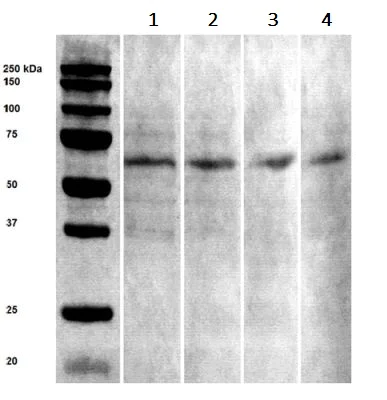 Western blot - Anti-ASIC1 antibody [S271-44] (AB240896)