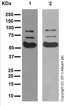 Western blot - Anti-ASIC2 antibody [EPR11029] (AB169768)