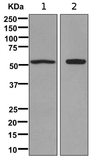 Western blot - Anti-ASIC2 antibody [EPR11029] - BSA and Azide free (AB249515)