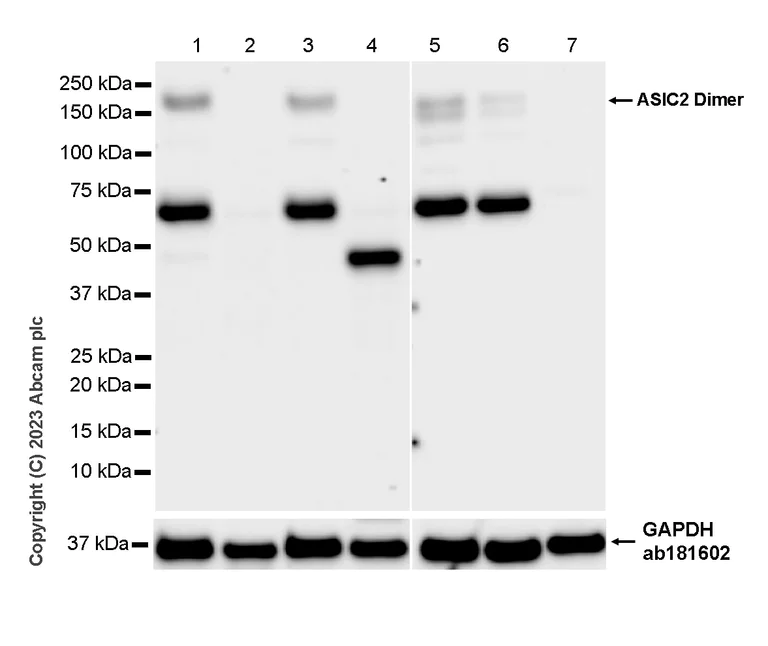 Western blot - Anti-ASIC2 antibody [EPR25412-63] - BSA and Azide free (AB315379)