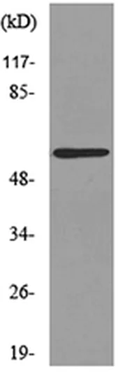 Western blot - Anti-ASIC3 antibody (AB190638)