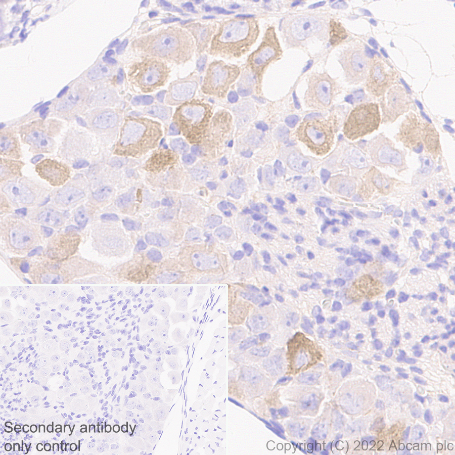 Immunohistochemistry - Anti-ASIC3 antibody [EPR26557-80] (ab302776), expandable thumbnail
