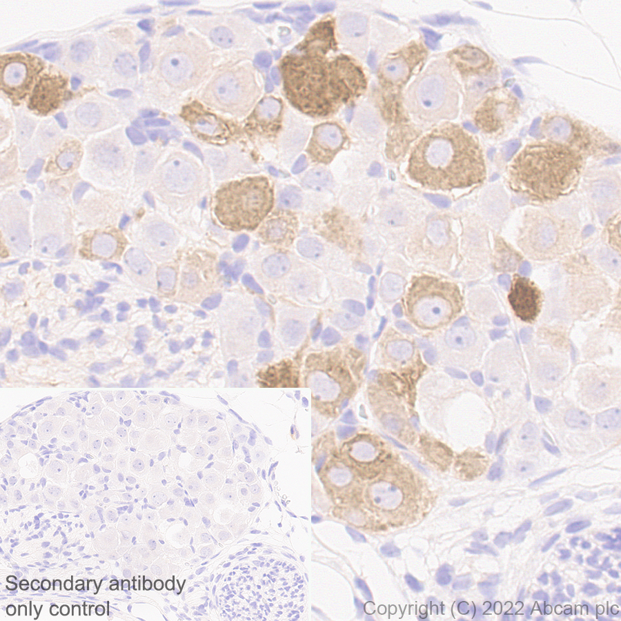 Immunohistochemistry - Anti-ASIC3 antibody [EPR26557-80] (ab302776), expandable thumbnail