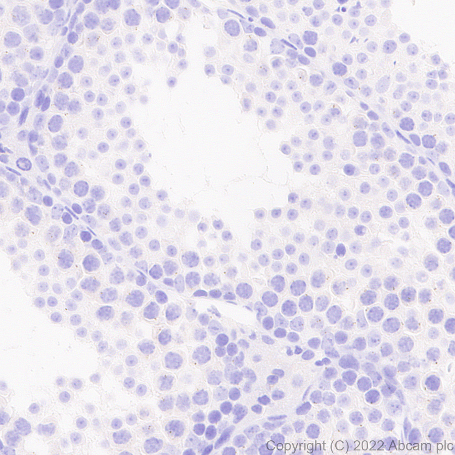 Immunohistochemistry - Anti-ASIC3 antibody [EPR26557-80] (AB302776), expandable thumbnail