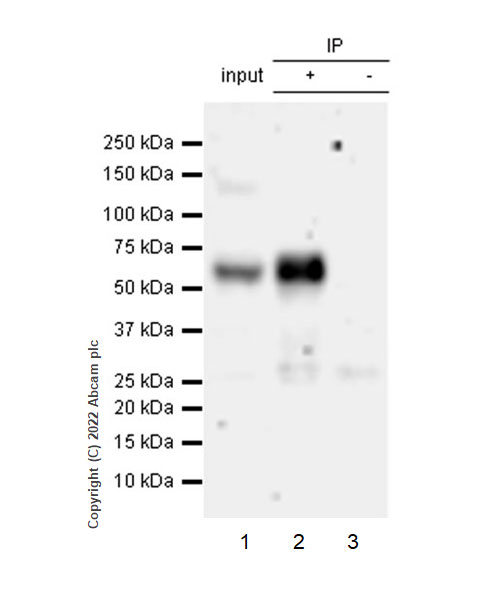 Immunoprecipitation - Anti-ASIC3 antibody [EPR26557-80] (AB302776), expandable thumbnail