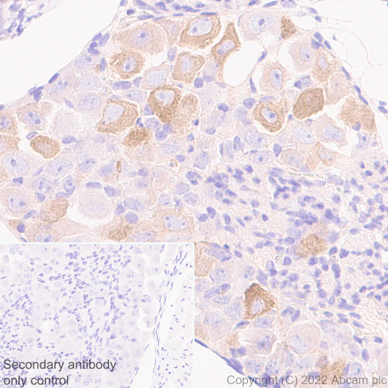 Immunohistochemistry - Anti-ASIC3 antibody [EPR26557-80] - BSA and Azide free (AB302777)