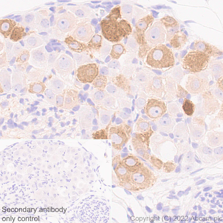 Immunohistochemistry - Anti-ASIC3 antibody [EPR26557-80] - BSA and Azide free (AB302777)