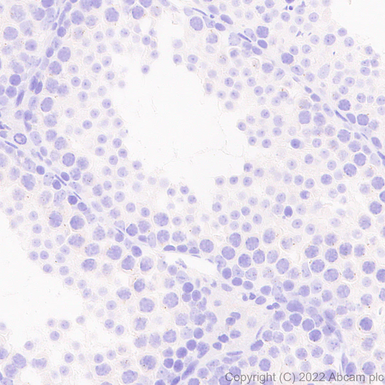 Immunohistochemistry - Anti-ASIC3 antibody [EPR26557-80] - BSA and Azide free (AB302777)