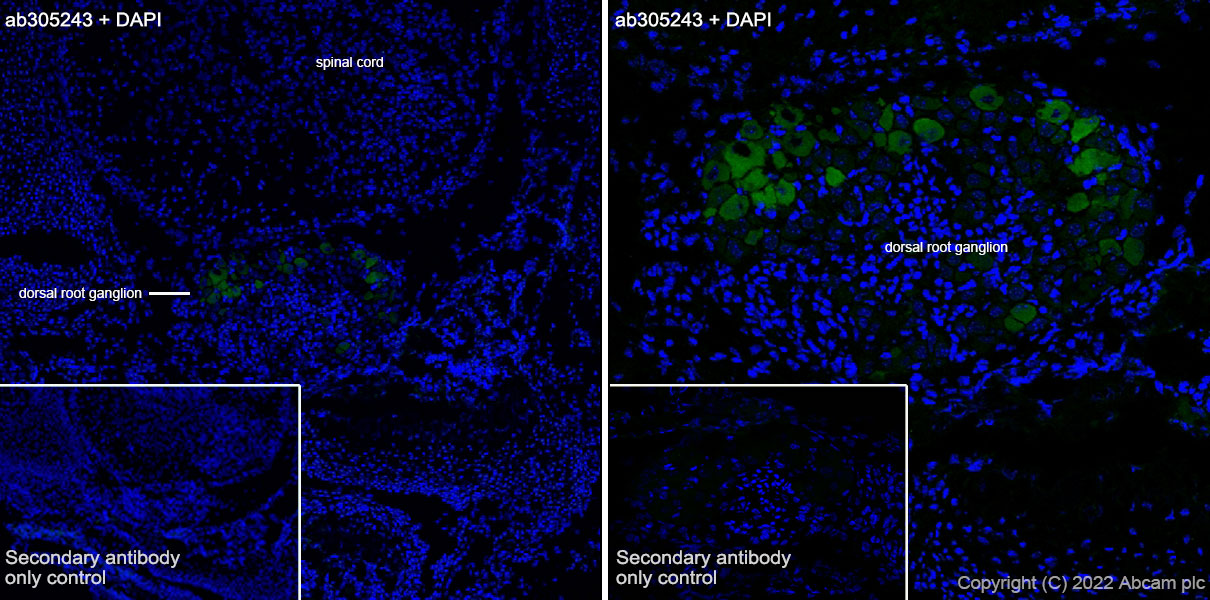 Immunohistochemistry (Frozen sections) - Anti-ASIC3 antibody [EPR26557-87] - BSA and Azide free (ab305244), expandable thumbnail