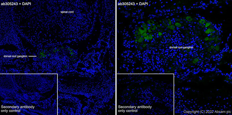 Immunohistochemistry (Frozen sections) - Anti-ASIC3 antibody [EPR26557-87] - BSA and Azide free (AB305244)