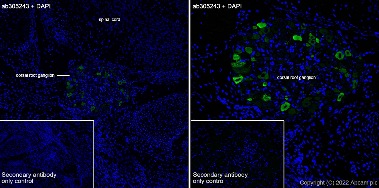 Immunohistochemistry (Frozen sections) - Anti-ASIC3 antibody [EPR26557-87] - BSA and Azide free (AB305244), expandable thumbnail