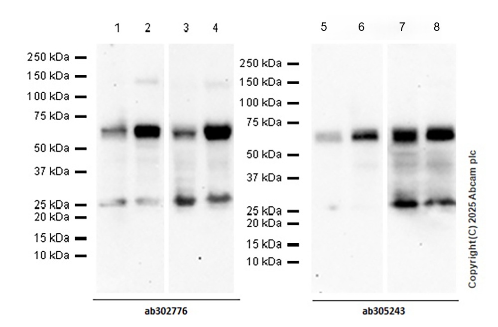 Western blot - Anti-ASIC3 antibody [EPR26557-87] - BSA and Azide free (AB305244), expandable thumbnail