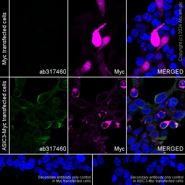 Immunocytochemistry/ Immunofluorescence - Anti-ASIC3 antibody [RM2049] (AB317460)