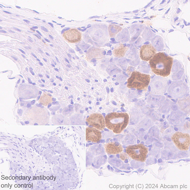 Immunohistochemistry (Formalin/PFA-fixed paraffin-embedded sections) - Anti-ASIC3 antibody [RM2049] (AB317460)