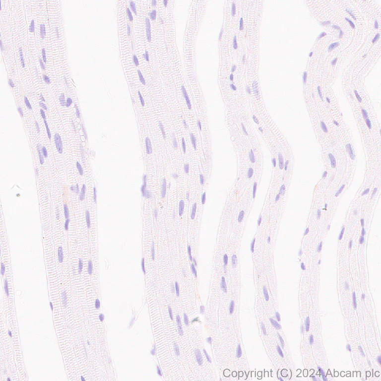 Immunohistochemistry (Formalin/PFA-fixed paraffin-embedded sections) - Anti-ASIC3 antibody [RM2049] (AB317460)