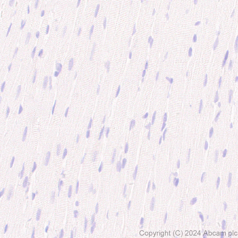 Immunohistochemistry (Formalin/PFA-fixed paraffin-embedded sections) - Anti-ASIC3 antibody [RM2049] (AB317460)